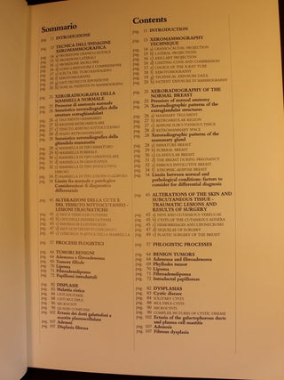 La Xeromammografia Xeromammography Signed