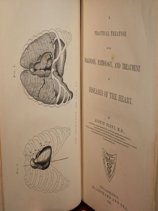 A Practical Treatise on the Diagnosis, Pathology, and Treatment of Diseases of the Heart
